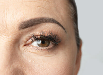 Eyelid Lift Services Montclair New Jersey